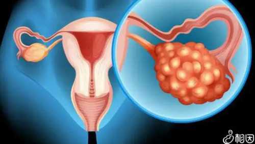 试管婴儿全过程需要多久，附试管城市导航！