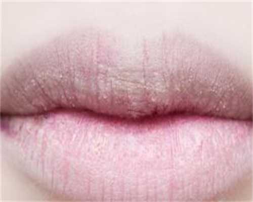 继发不孕可以直接做试管吗？继发性不孕症可以试管婴儿吗