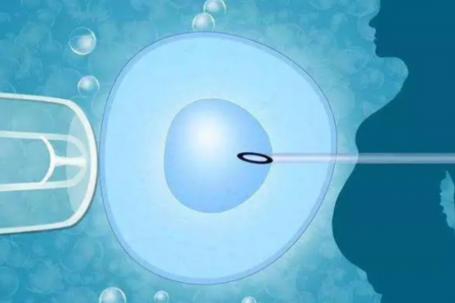 东骏国际助孕(贝乐孕生殖怎么样),试管的步骤回答你移植后便秘怎么办