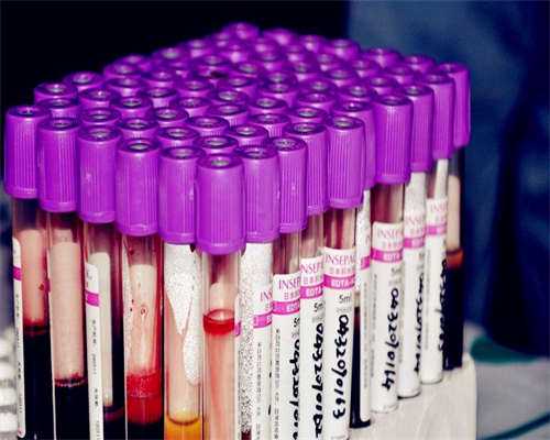 坤和代孕花费,试管婴儿存在风险的原因