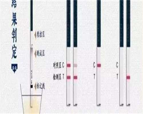 55万元包成功_代怀供卵包男孩,孕期妊娠纹怎么淡化祛除
