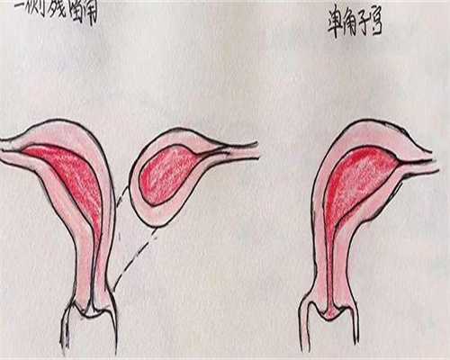 孺愿助孕官网_试管生卵怎么办,华西二胎试管多少钱(华西第二医院试管)