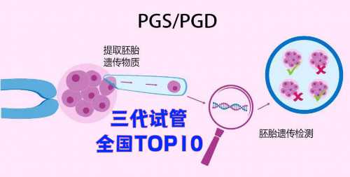 做代孕最好的医院,子宫畸形是怎么造成的(子宫畸形有哪些检查项目)