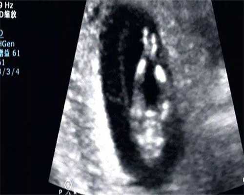 国内供卵要多长时间,国内供精供卵需要多少钱一次,2026云浮试管医院比较新收