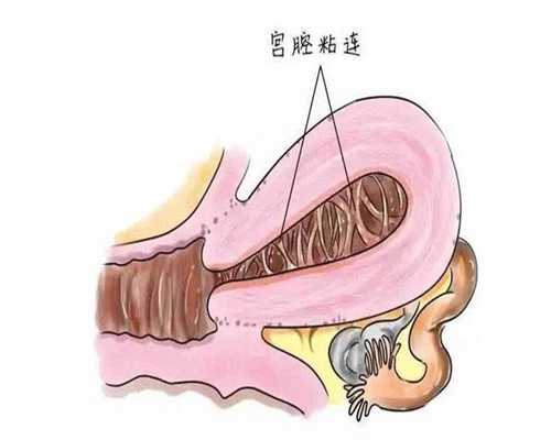 哈萨克斯坦试管婴儿Sheng多少钱，费用三万够不够！