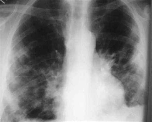 专业代孕咨询机构_55万包成功零风险,【dhea在美国停产禁售】美国为什么不卖