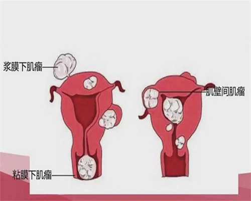 哪里做试管包男孩,y染色体c段缺失可以做试管吗-y染色体c段微缺失