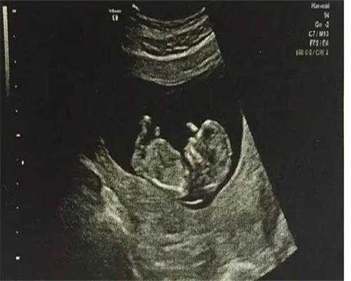 
              代生中介价格促排针必须要在每天早上8点打吗？
