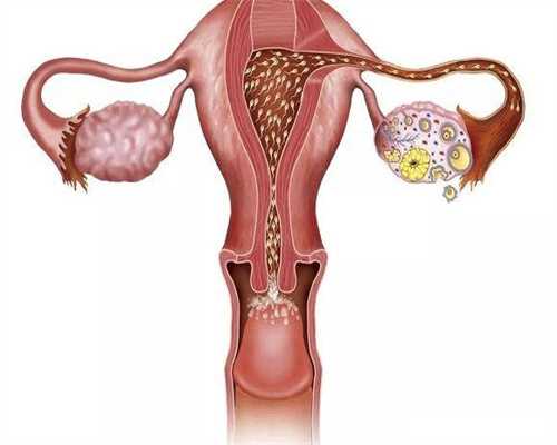 越南可以做未婚试管